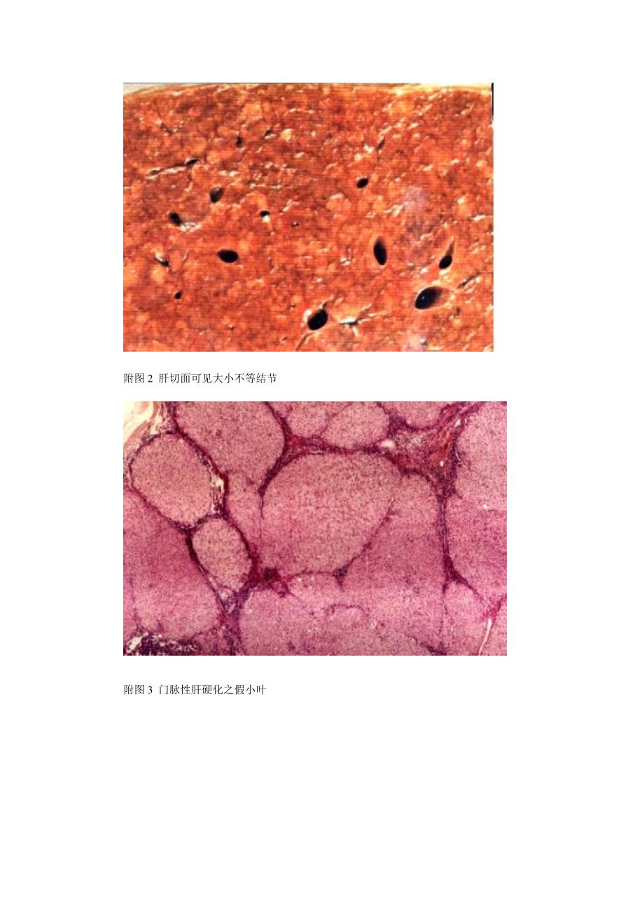 系统病理学病例分析1_第4页