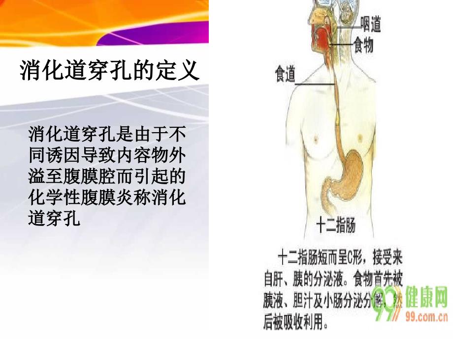 消化道穿孔护理查房_第3页