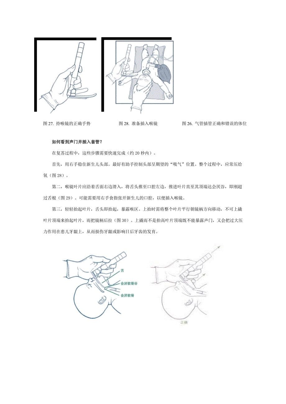 新生儿窒息复苏(下)_第5页