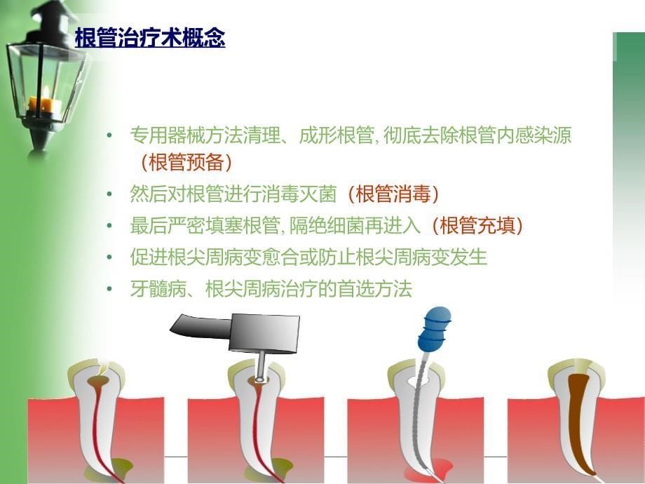 根管治疗rct_第5页