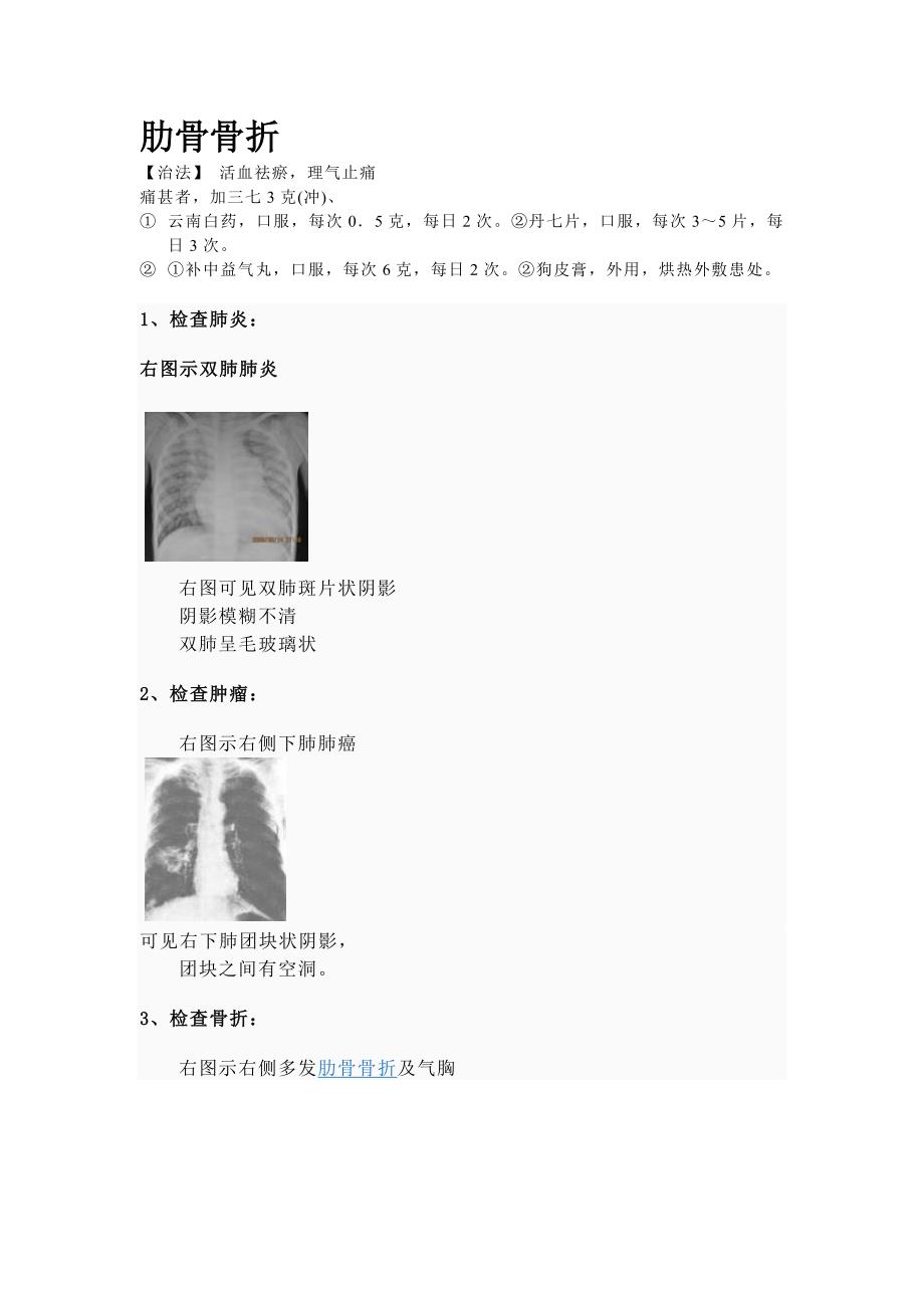肋骨骨折x线图_第1页