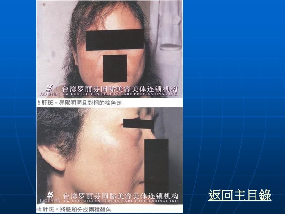 医学美容概论_第5页