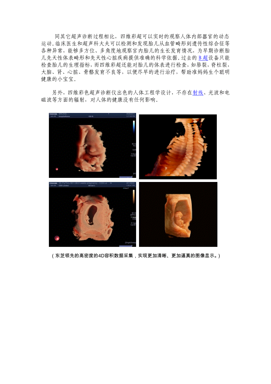 新一代高端实时超声诊断系统_第2页