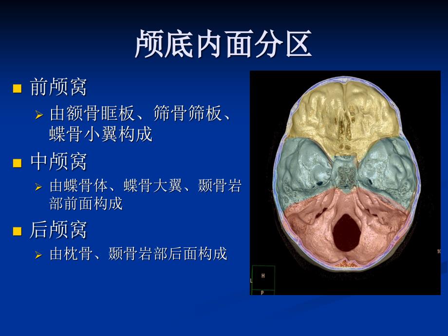 颅底影像解剖_第4页