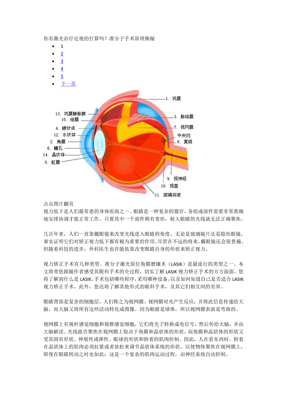 你有激光治疗近视的打算吗_第1页