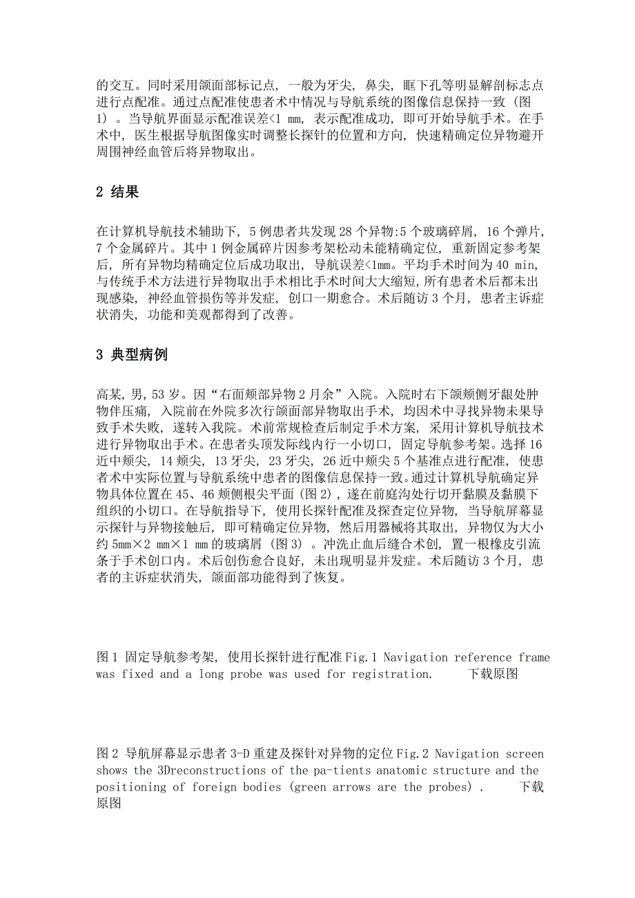 计算机导航技术在口腔颌面部异物取出手术中的应用_第4页