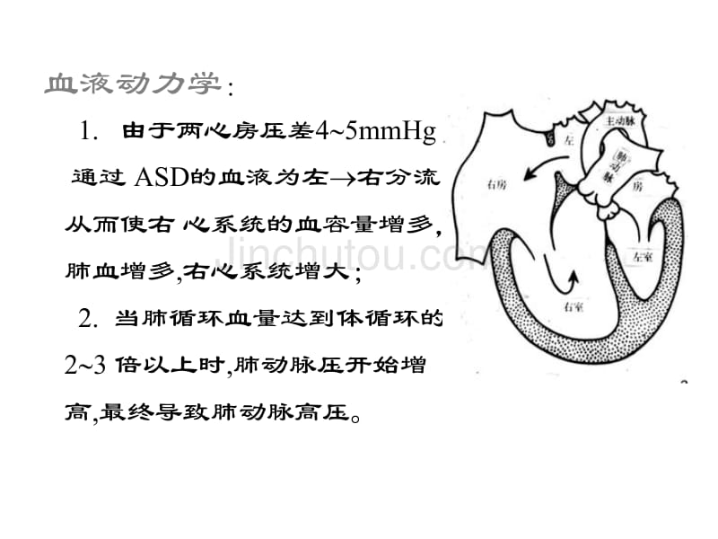 先天性心血管病_第4页