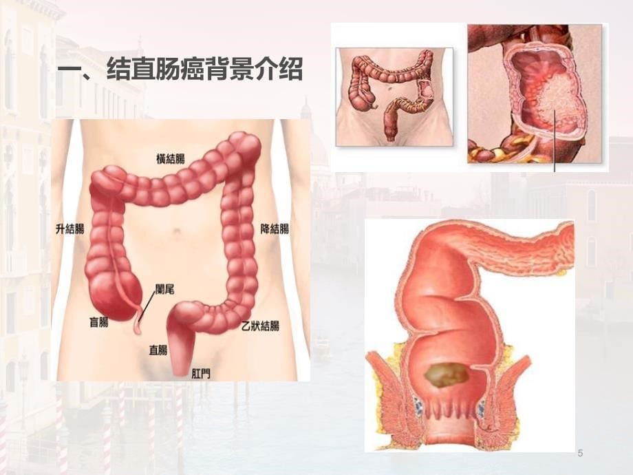 多发性骨髓瘤治疗现状_第5页