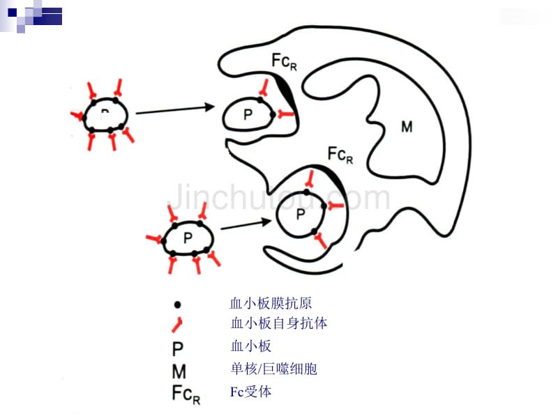 特发型血小板减少性紫癜_第5页