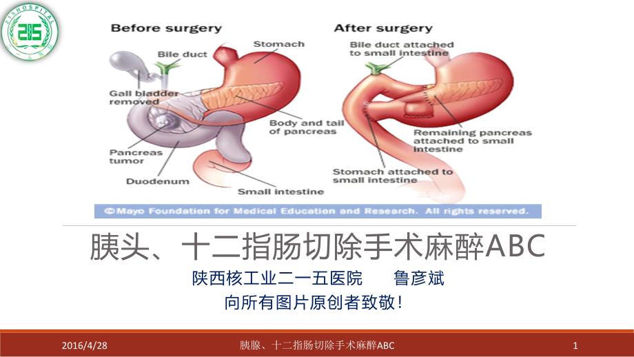 胰腺、十二指肠手术麻醉ABC鲁彦斌_第1页