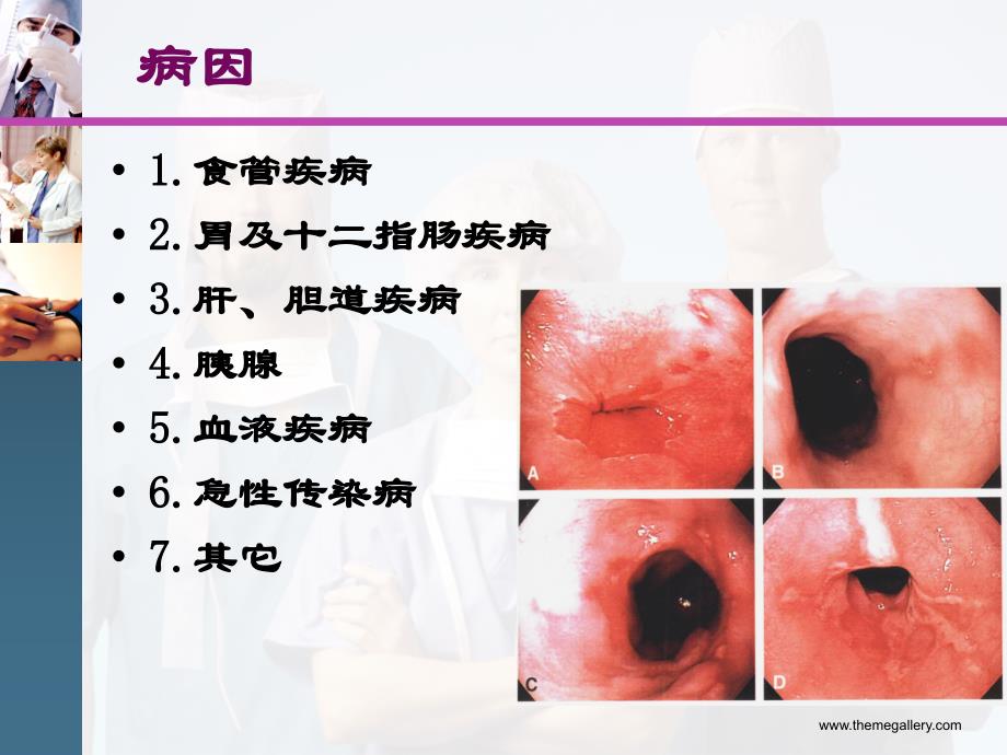 临床医学概要呕血与便血_第4页