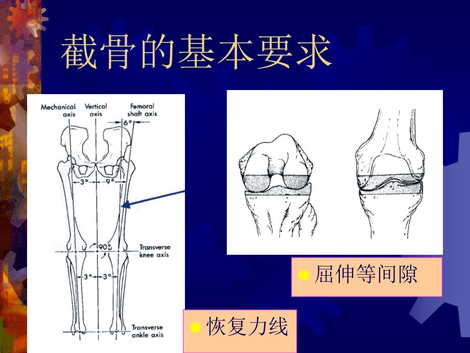 全膝关节置换术中的截骨与软组织平衡_第4页