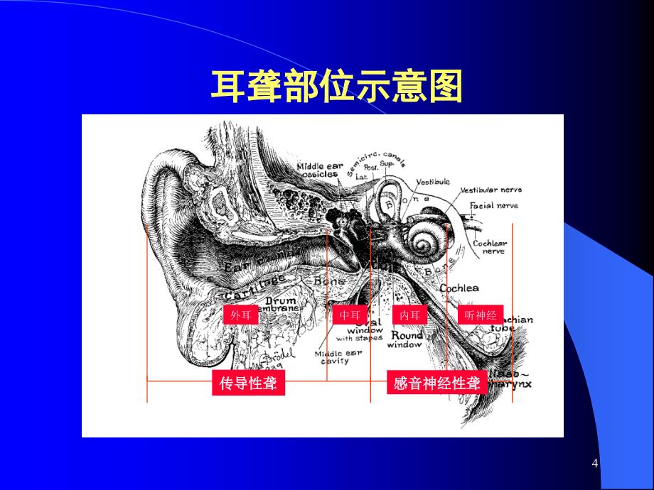 耳聋及其防治_第4页