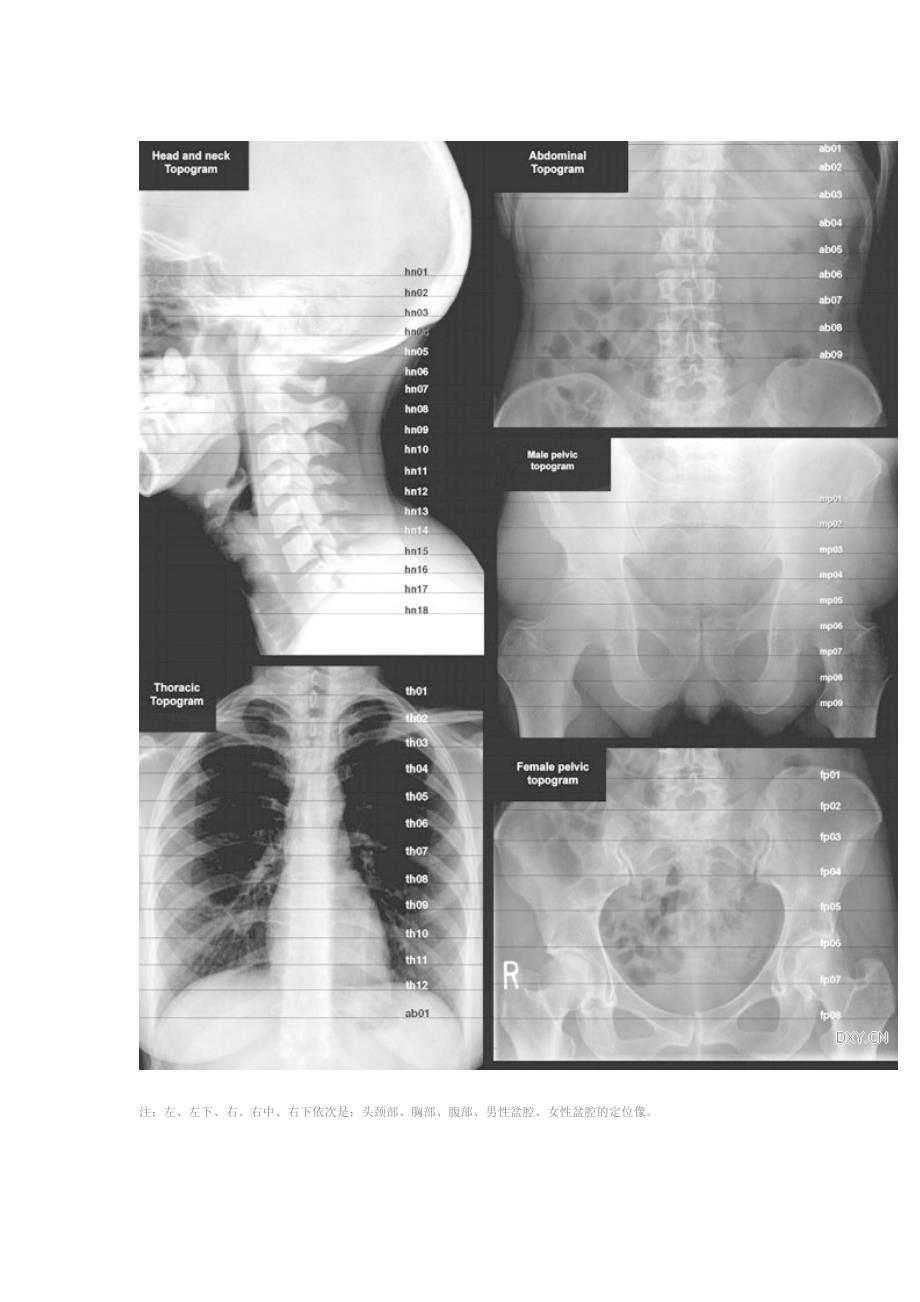 经典：全身淋巴结分区 ct 图谱_第2页