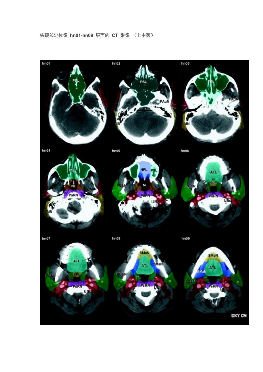 经典：全身淋巴结分区 ct 图谱_第3页