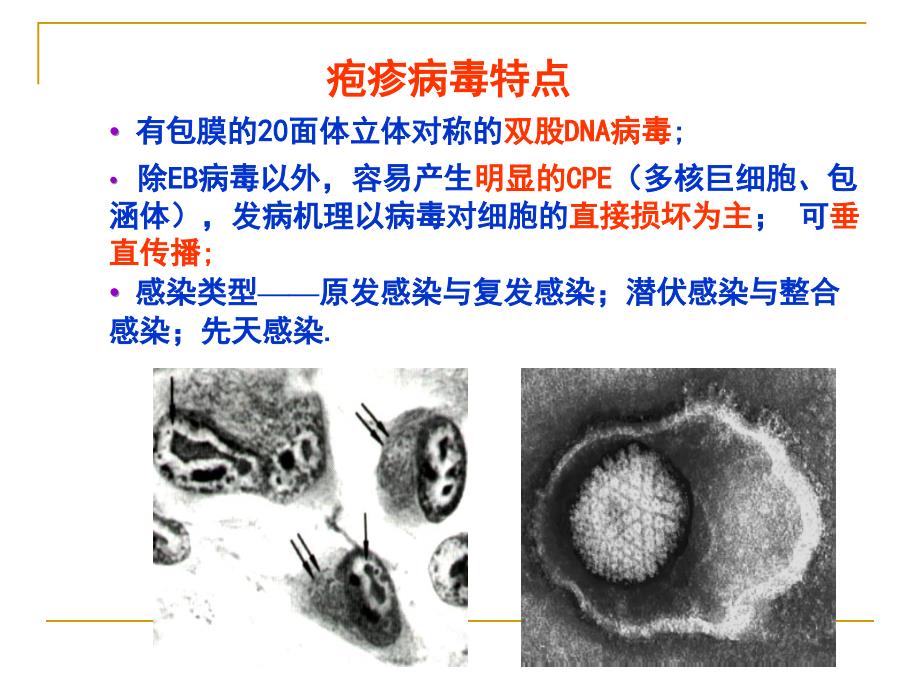 基础医学概要三疱疹病毒_第4页