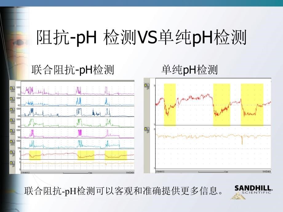 为什么用阻抗技术检测胃食管反流_第5页