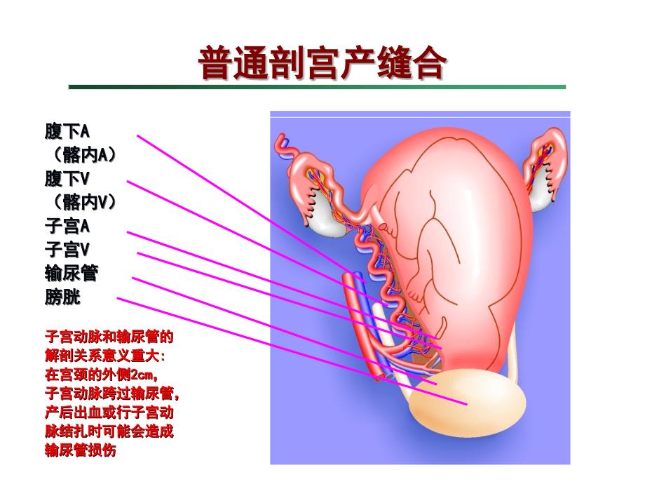 剖宫产手术缝合技术_第2页