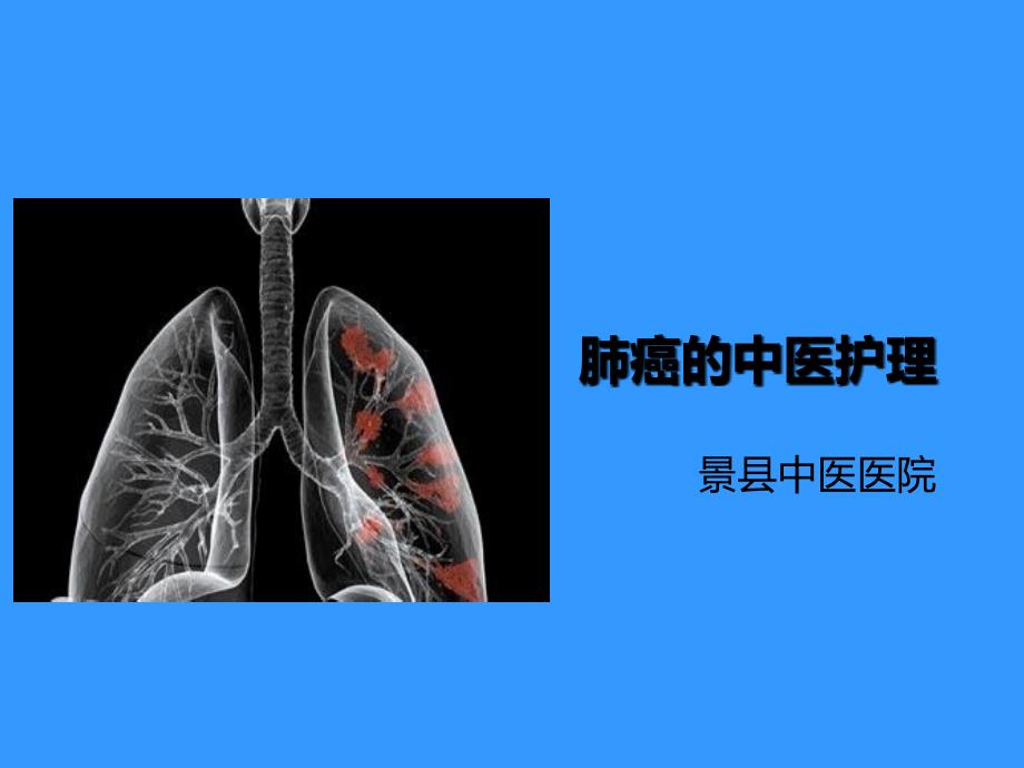 肺癌的中医护理_第1页