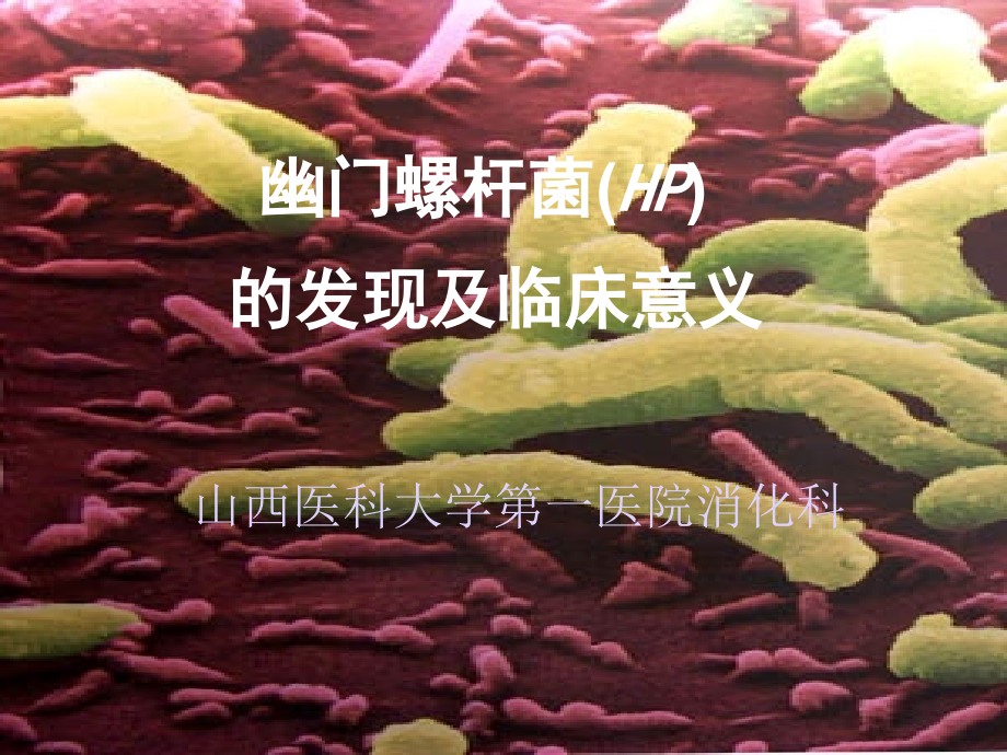 幽门螺杆菌感染研究进展_第1页