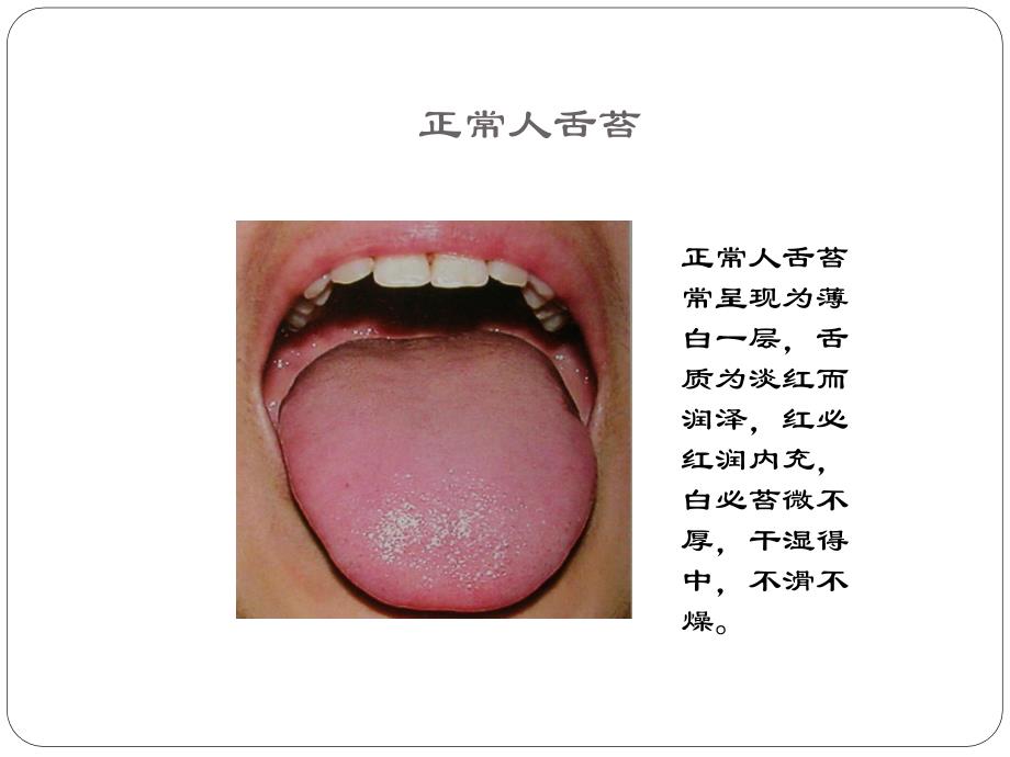 舌诊在胃病治疗中的指导作用_第4页