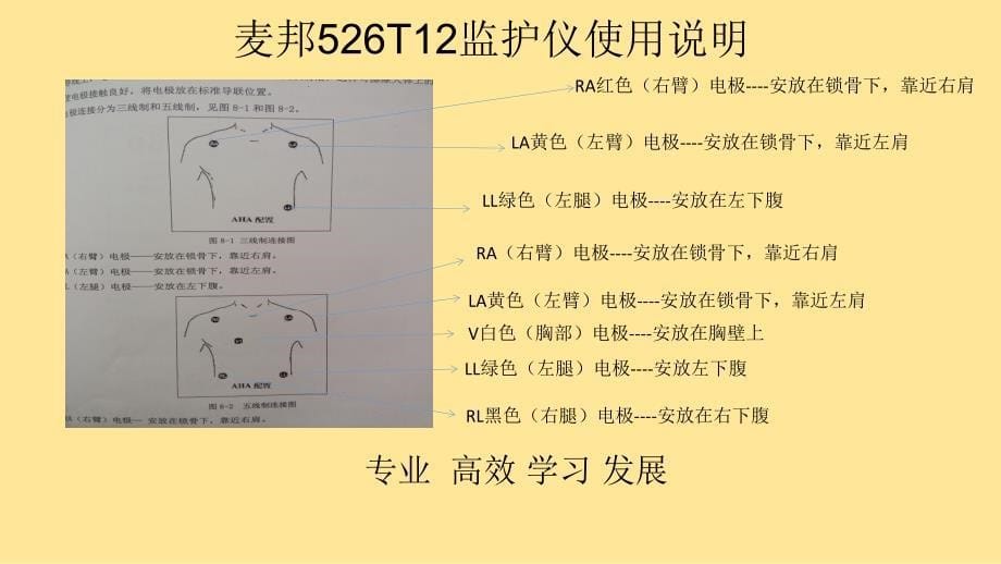 麦邦__监护仪__培训___课件_第5页