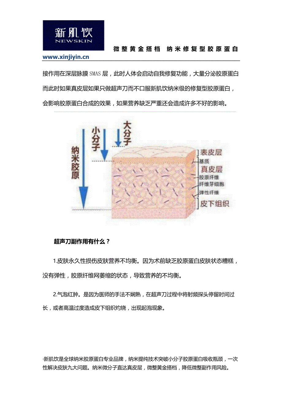 超声刀副作用如何预防_第2页