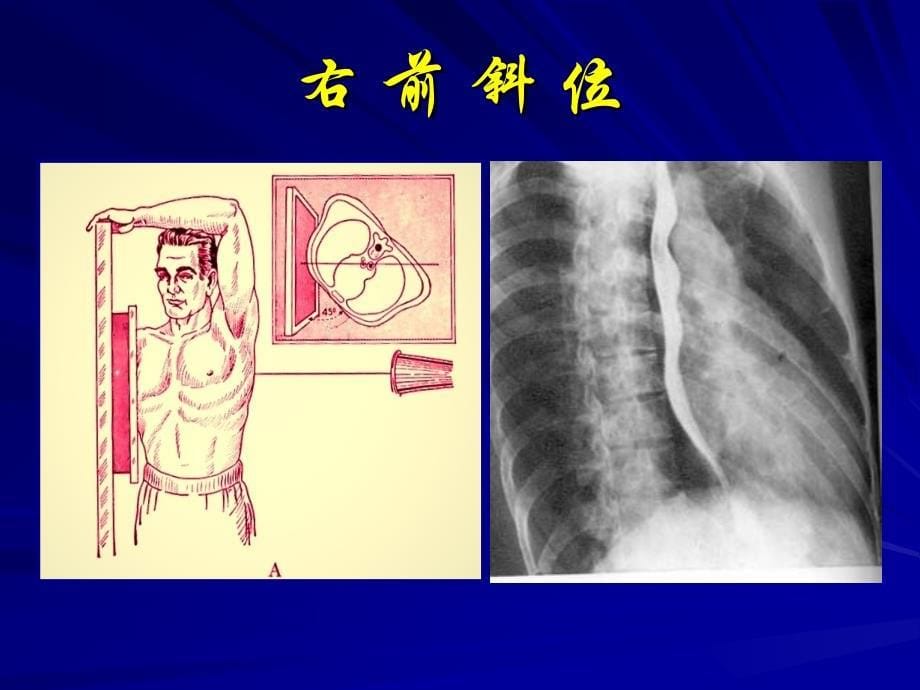 循环系统影像诊断_第5页