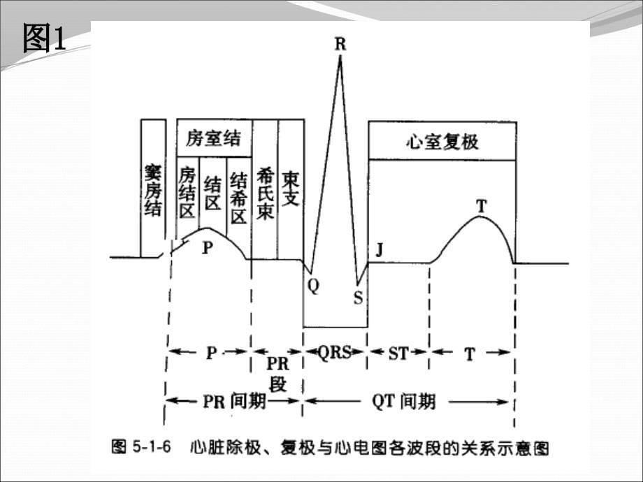 心电图读图训练_第5页