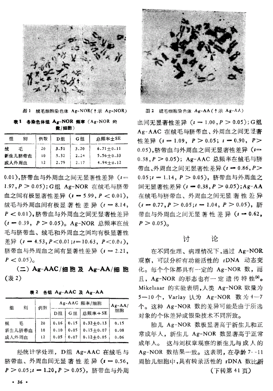 绒毛染色体核仁形成区的观察_第2页