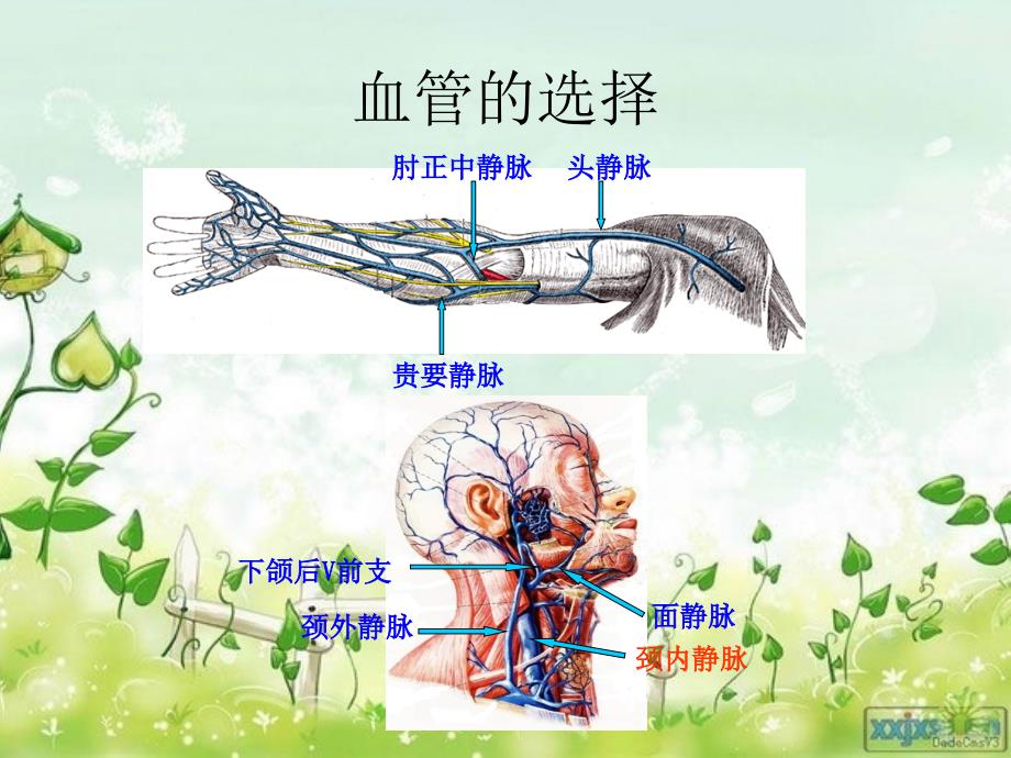 PICC的置管维护及常见并发症_第4页