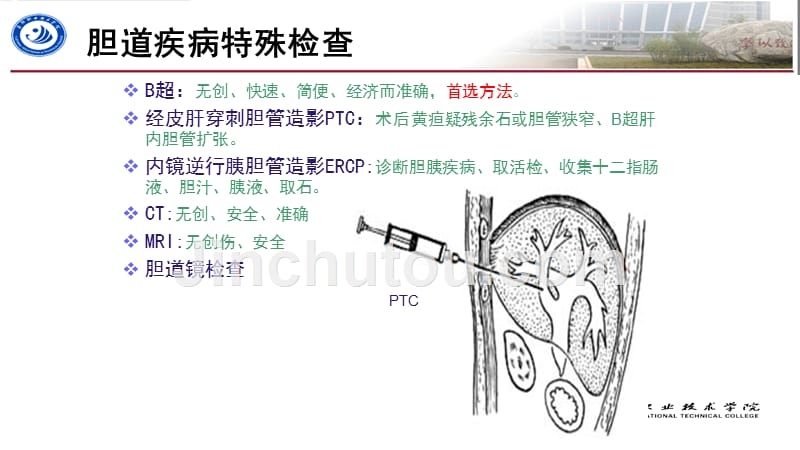 胆石症患者的护理_第5页