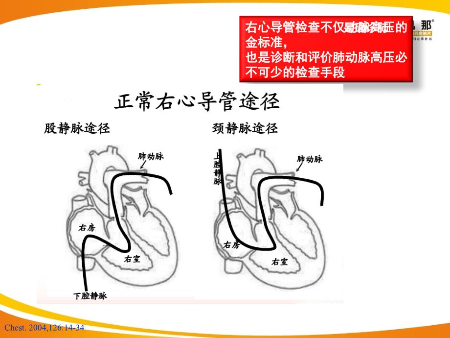 肺动脉高压指南_第3页