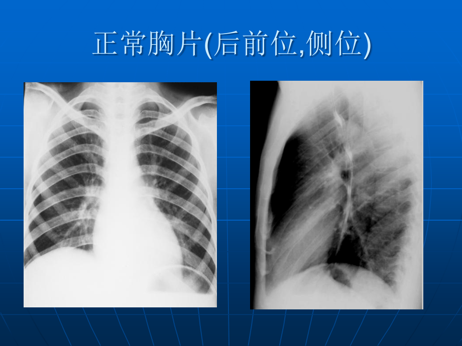 X线片读片辅导参考_第3页