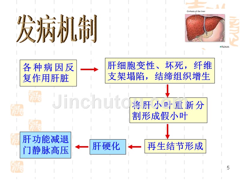 肝硬化病人的护理查房_第5页