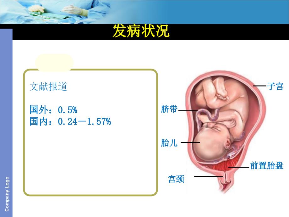 前置胎盘查房最新_第2页