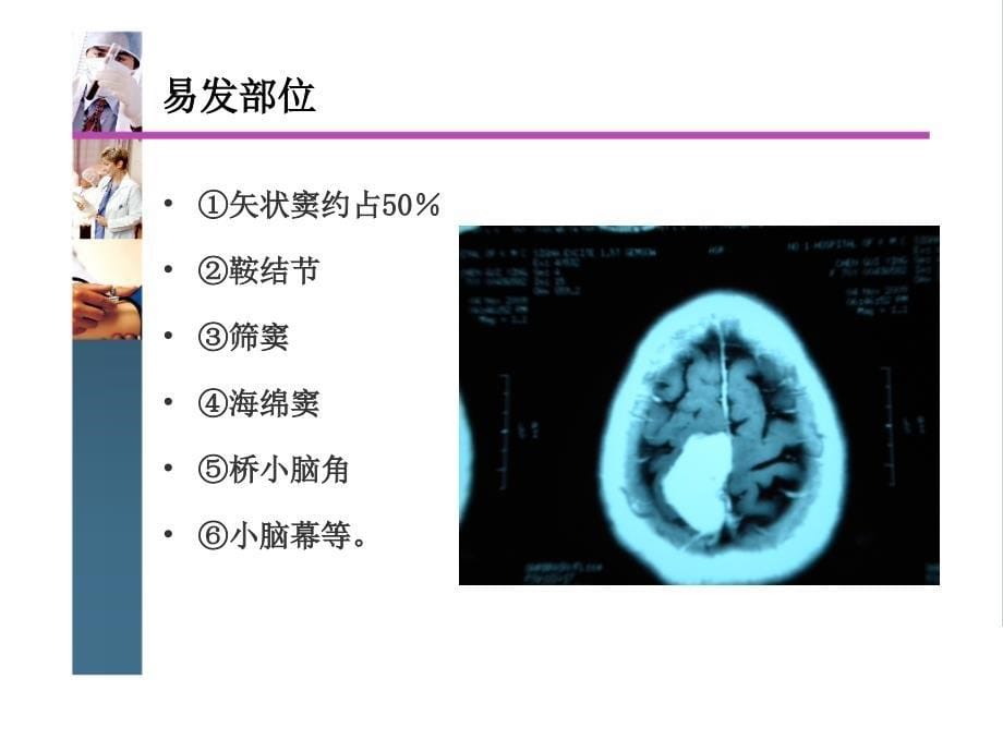 颅内肿瘤切除术后体会_第5页