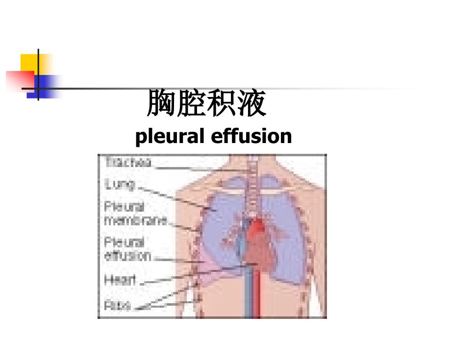 胸腔积液的定义_第1页