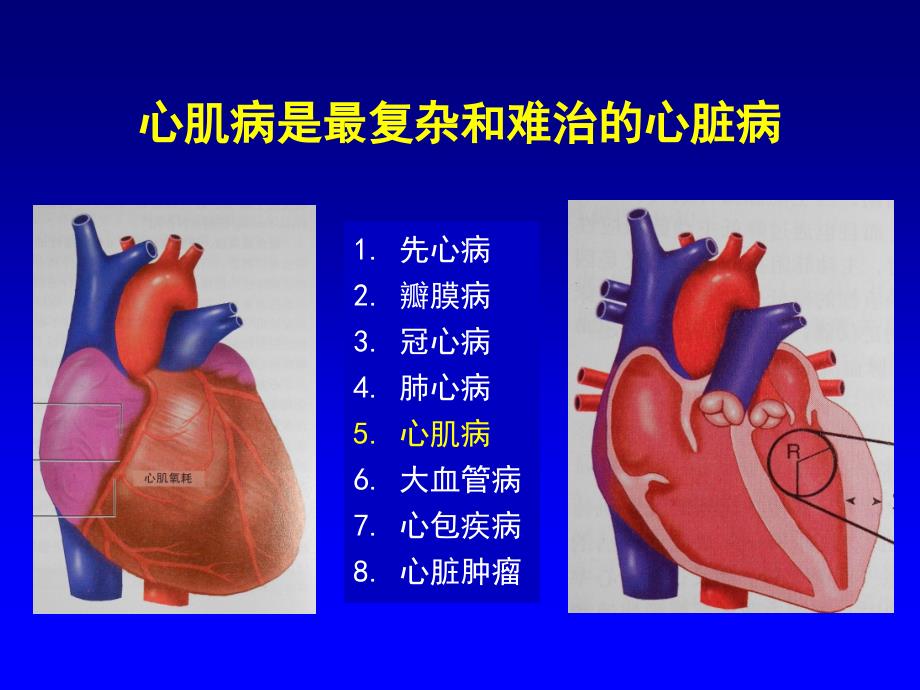 心肌病分类进展_第2页