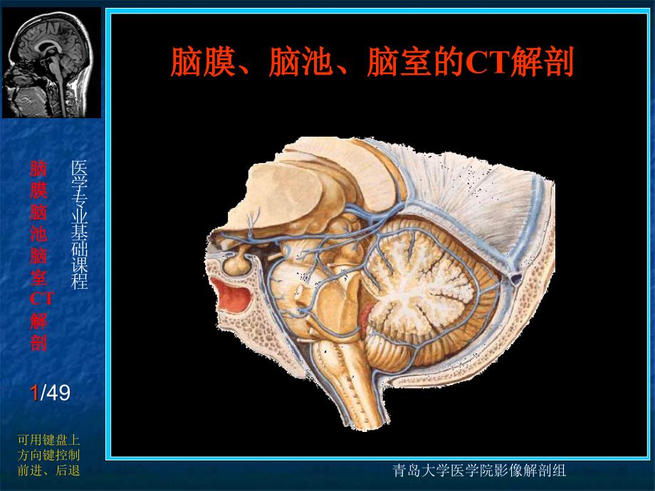 脑膜脑池脑室的CT解剖_第1页