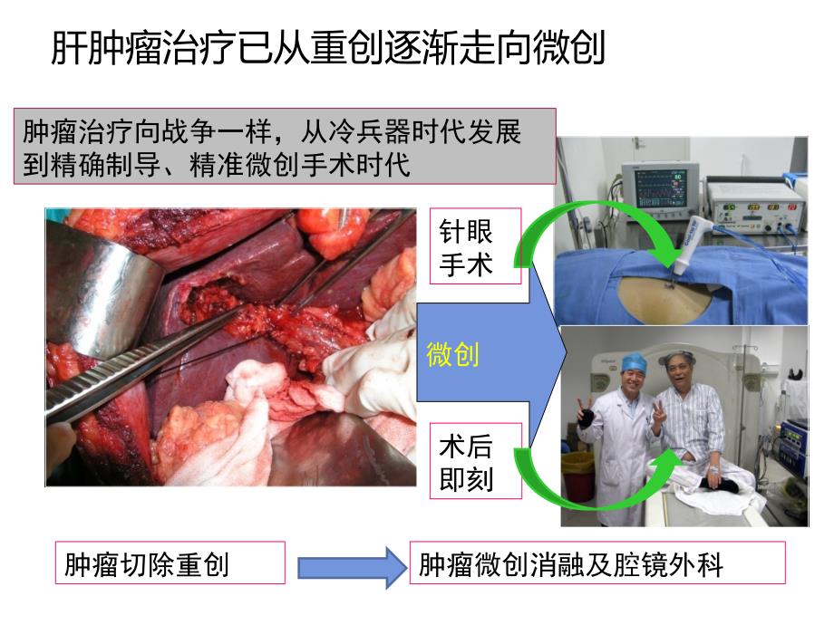 肿瘤物理消融治疗新进展_第4页