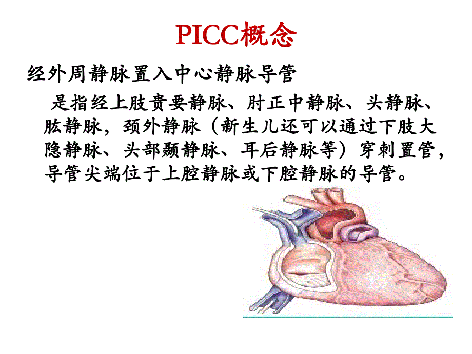 picc概念及特点_第2页