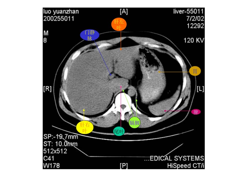 腹部CT断层解剖结构_第4页