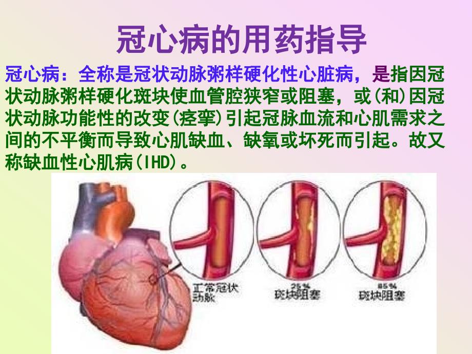 项目十  冠心病的用药指导_第1页