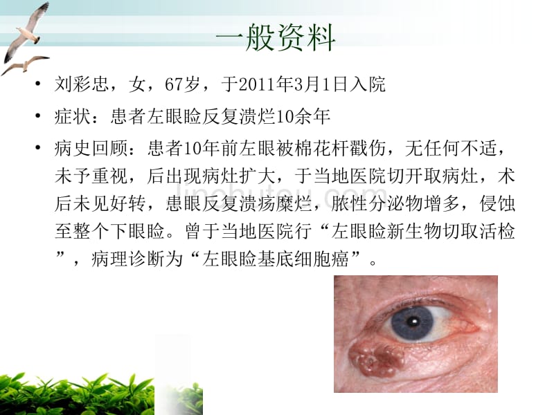 眼睑基底细胞癌围手术期护理_第5页