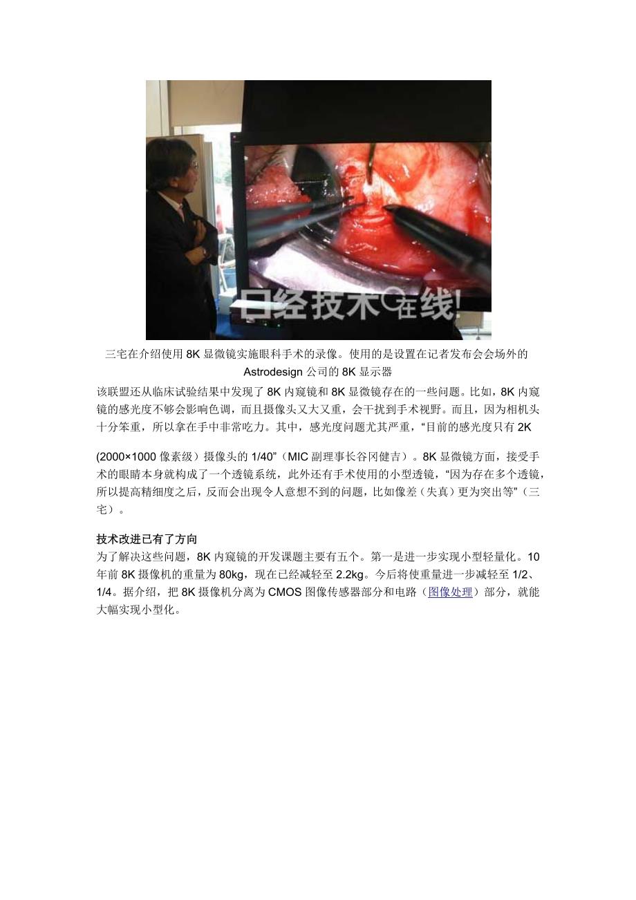 世界首例8k摄像脑外科手术镜头曝光_第4页