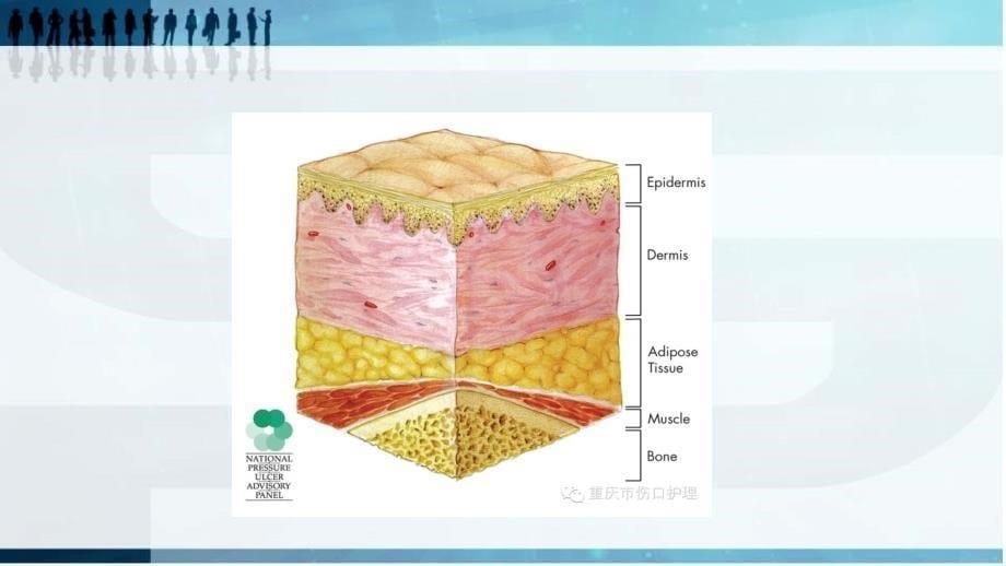 压疮新进展压疮评估与护理_第5页