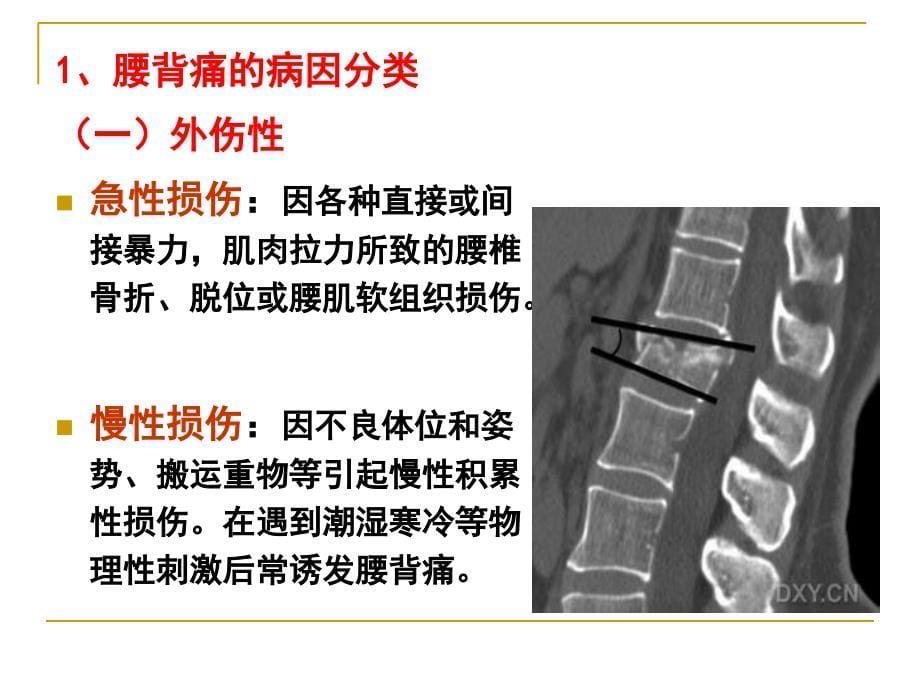 腰背痛朱前超_第5页