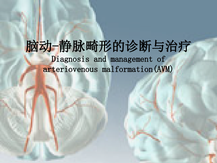 脑动静脉畸形的诊治_第1页