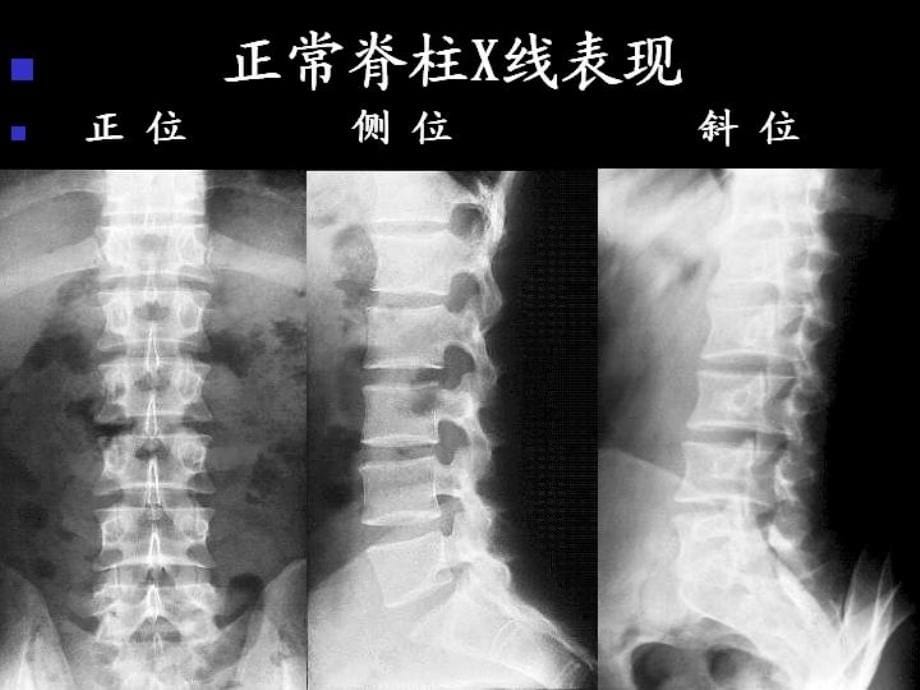 医学影像学图片_第5页